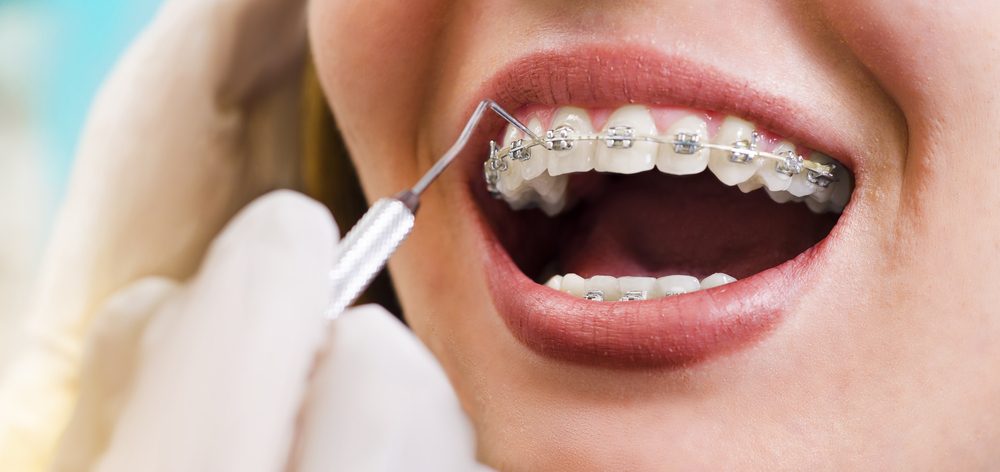 Клініка стоматології Посмішка - акції та купони знижок на Pokupon